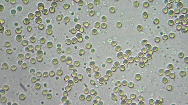 drop of my blood (erythrocytes) under microscope