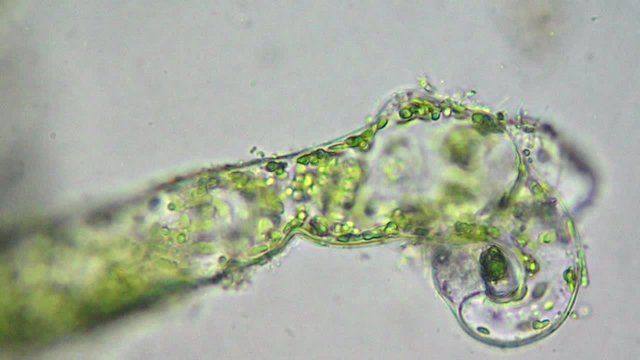 Seaweed (algae) under microscope, magnification 400x