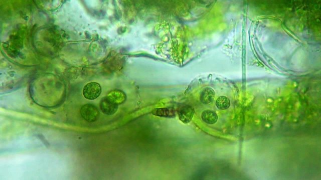 Seaweed (algae) under microscope, magnification 400x