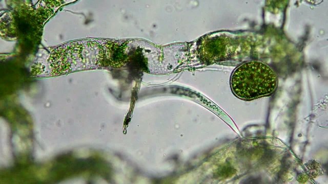 Seaweed (algae) under microscope, magnification 400x