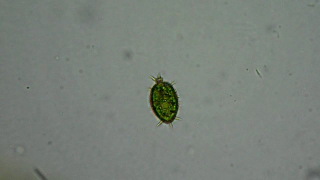 Green cyanobacteria colony under microscope