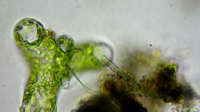 Seaweed (algae) under microscope, magnification 400x