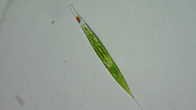 Green algae cells under microscope