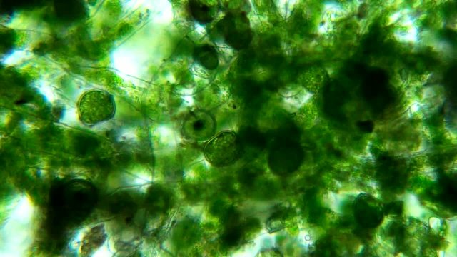 Seaweed (algae) under microscope, magnification 400x