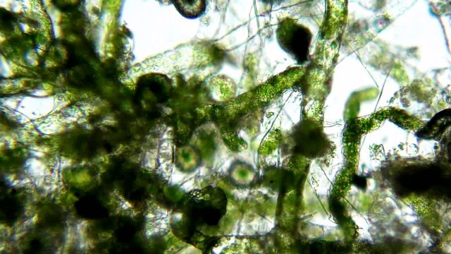 Seaweed (algae) under microscope, magnification 400x