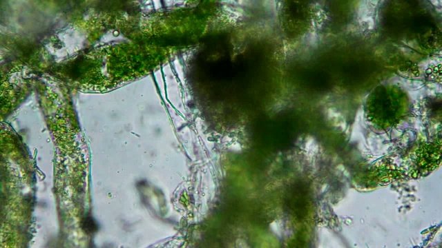 Seaweed (algae) under microscope, magnification 400x