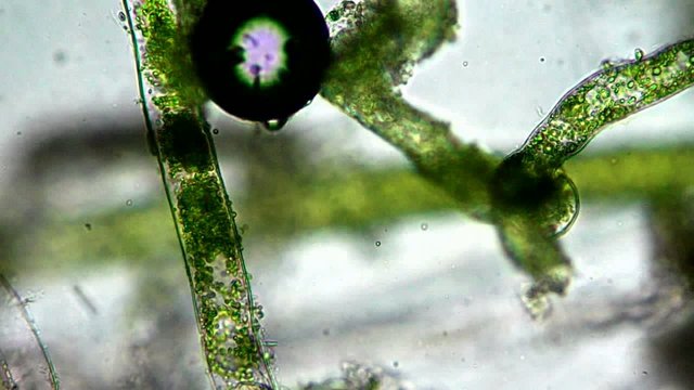 Seaweed (algae) under microscope, magnification 400x