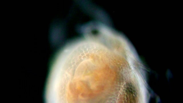 daphnia closeup and infusoria under microscope
