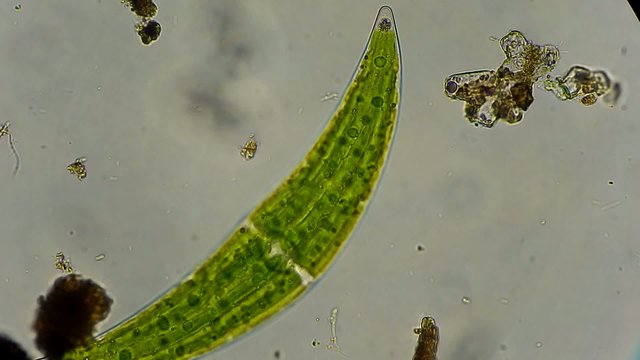 closterium algae under microscope