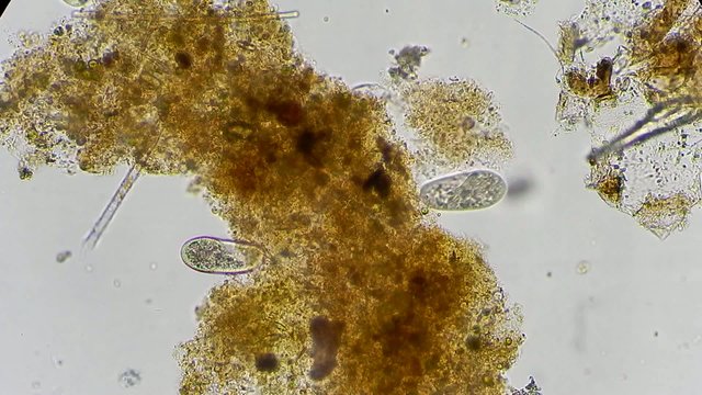 Live single-celled protist under microscope