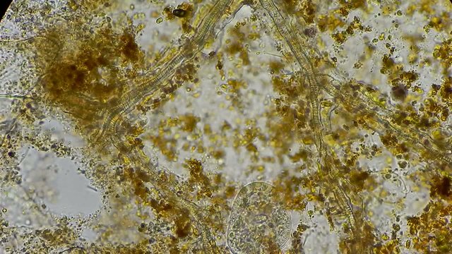 Live single-celled protist under microscope