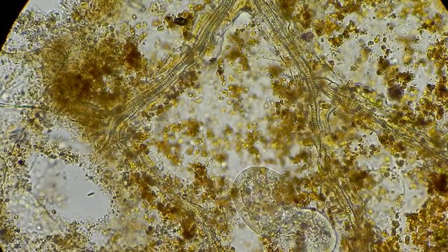 Live single-celled protist under microscope