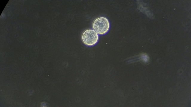 cells of paramecium dividing under microscope