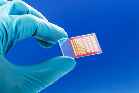 chromatography genetic fingerprinting
