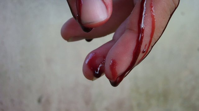 Hand of blood.
