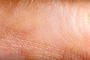 Close up human skin. Macro epidermis