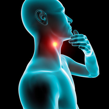 Mal di gola infiammazione arrossamento dolore