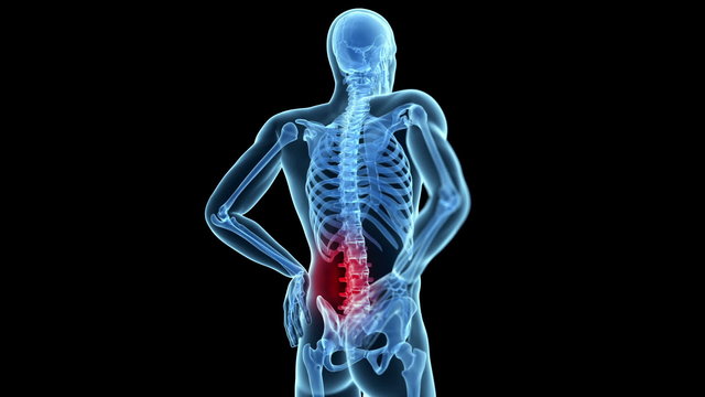 Medical animation of a man having a backache