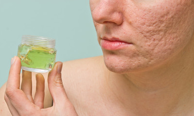 Problematic skin treatment