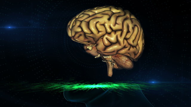 Brain scan