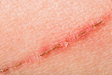 Texture of human skin and scratch