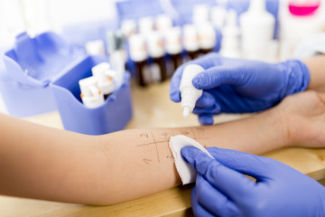 Allergy - skin prick tests