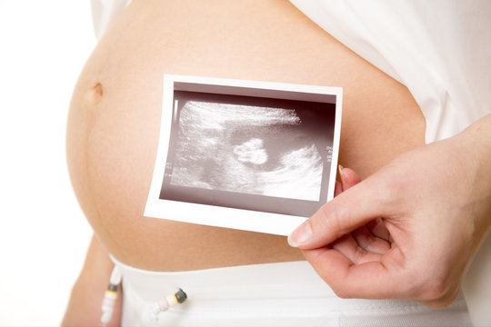 Pregnant with ultrasounds
