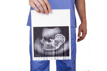 Ban on abortion