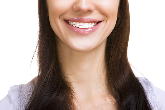 Beautiful smiling girl with retainer for teeth isolated