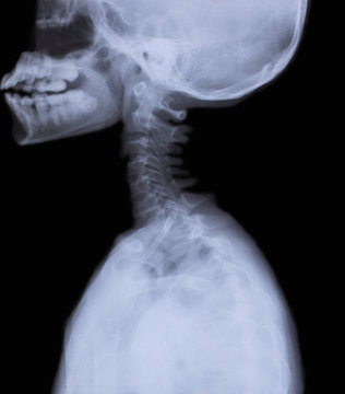 detail of neck and head x-ray image