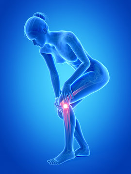 3d rendered illustration - female having a painful knee