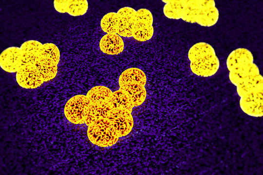 MRSA bacteria or superbug bacteria