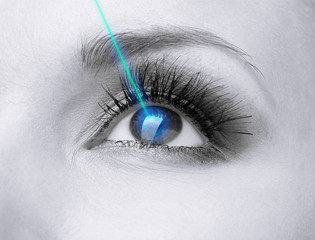 Laser vision correction. Woman's  eye.