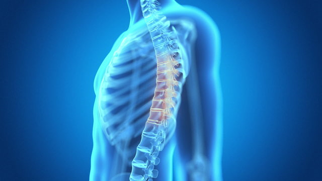 medical animation - pain in the spine