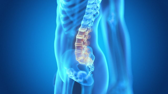medical animation - painful lower back
