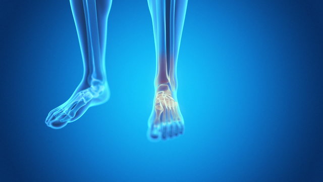 medical animation - pain in the foot