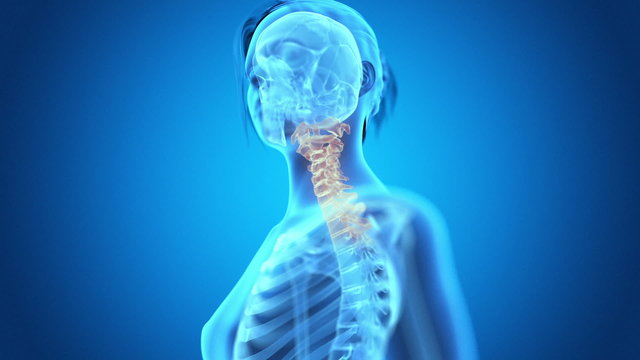 medical animation - pain in the neck