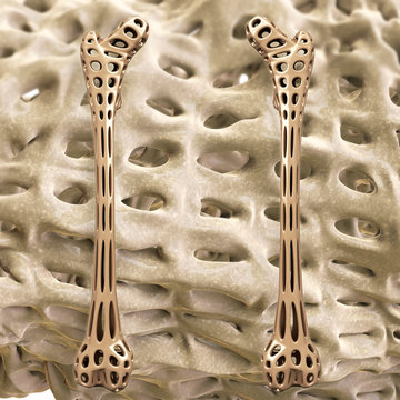 Osteoporose Oberschenkel - 3d Render