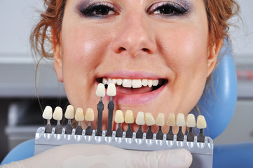 shade determination tooth