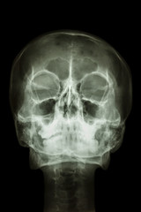 normal human's skull and cervical spine