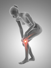medical 3d illustration - woman having pain in the knee