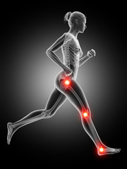 Obraz premium medical 3d illustration - jogger having pain in the joints