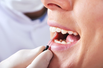dentist examines teeth