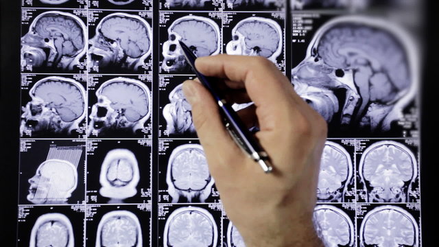 Doctor analyzes results of a magnetic tomography.
