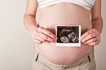 Pregnant woman holding an ultrasound scan
