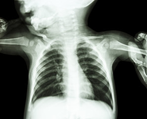 body of child and adult is holding at both child's arm