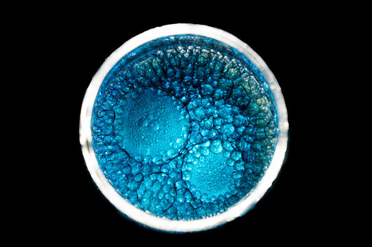 blue cells dividing form a bigger one