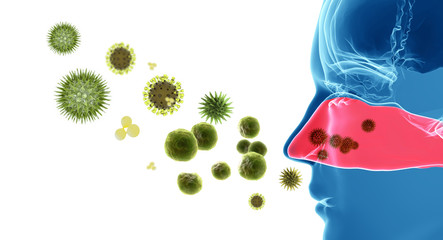 Pollen allergy / Hay fever - 62330888