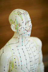 Acupuncture