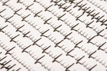 Fototapeta premium Extrasystoles On Electrocardiogram Record Paper